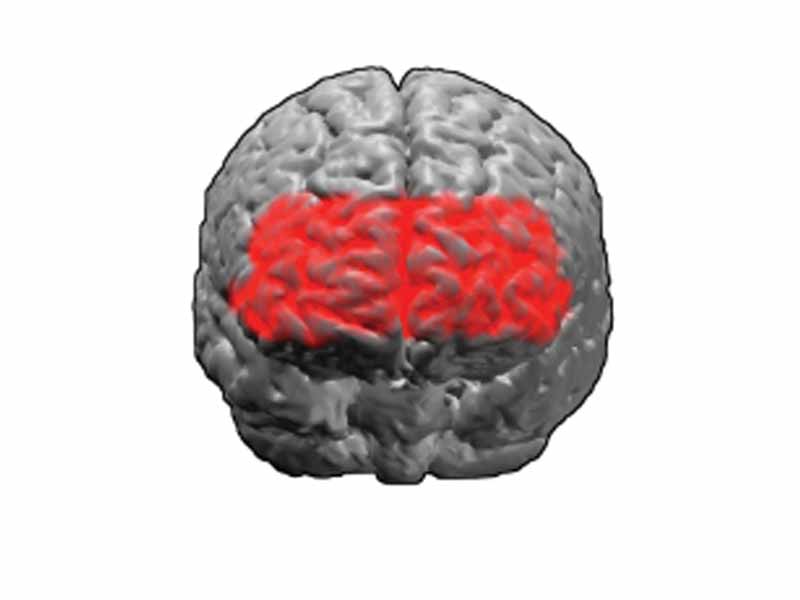 Brodmann area 10. BA10 is in the anterior (front) part of the frontal lobe.