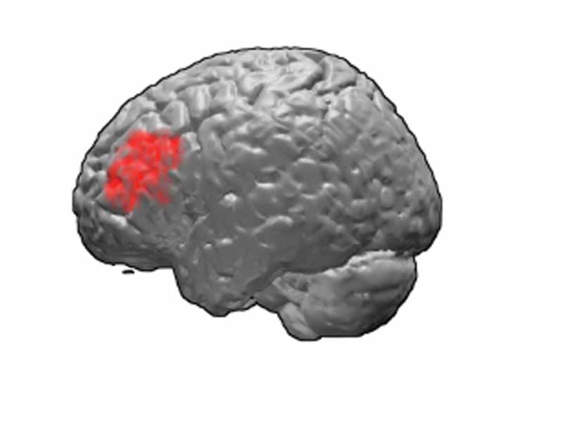Brodmann area 46. BA46 is in the frontal lobe.