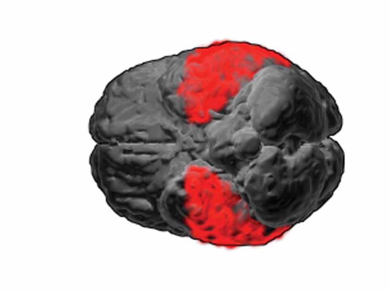 Brodmann area 20. BA20 is in the ventral temporal lobe.