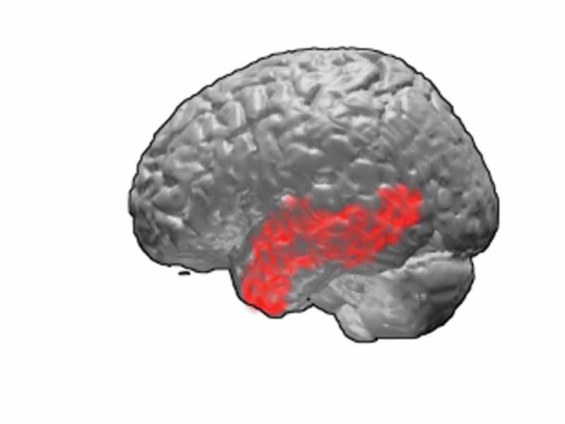 Brodmann area 21. BA 21 lies on the lateral surface (side) of the temporal lobe.