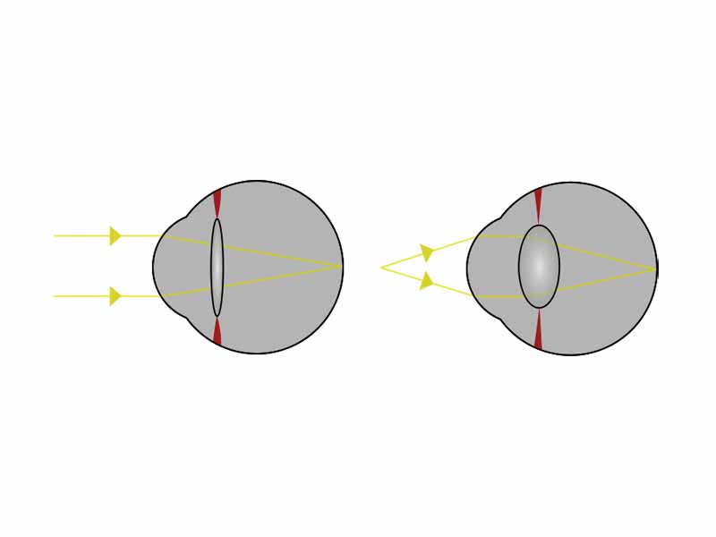 Light from a single point of a distant object and light from a single point of a near object being brought to a focus
