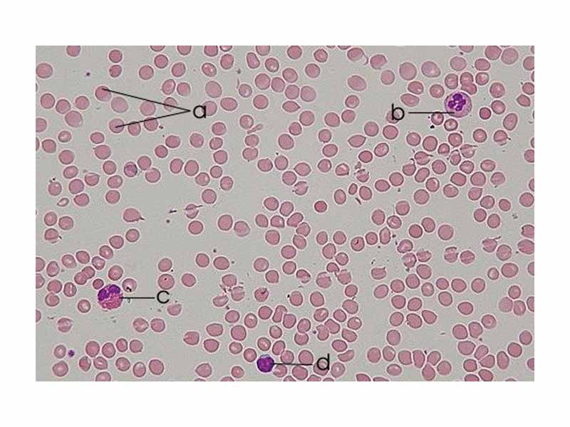 Human blood smear: a - erythrocytes; b - neutrophil; c - eosinophil; d - lymphocyte.