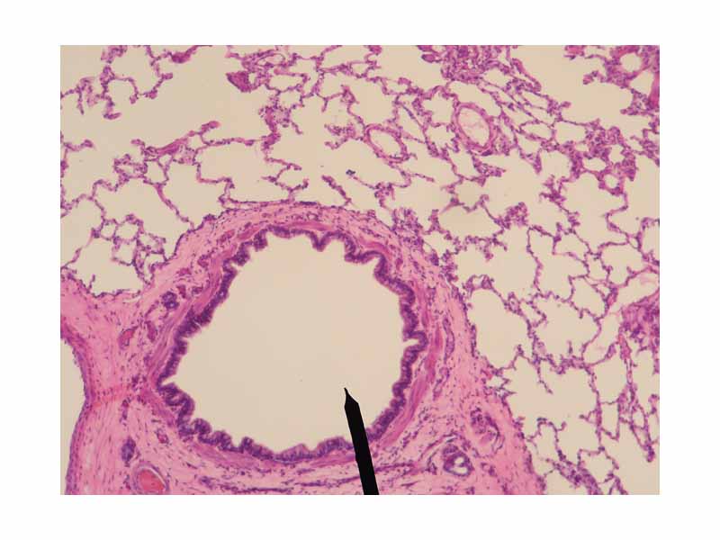 Cross sectional cut of terminal bronchiole