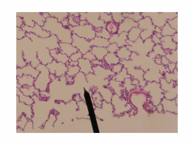 Human alveolar duct
