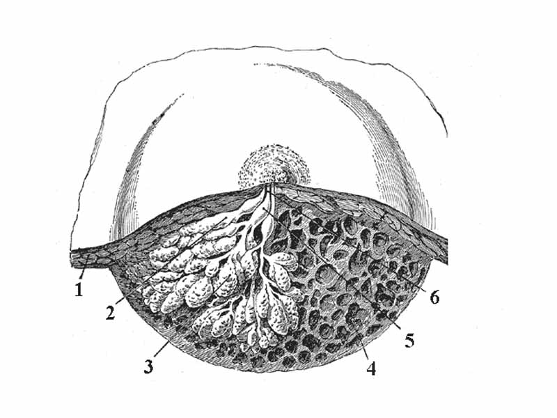 Dissection of a lactating breast. - 1 - Fat - 2 - Lactiferous duct/lobule - 3 - Lobule - 4 - Connective tissue - 5 - Sinus of lactiferous duct - 6 - Lactiferous duct
