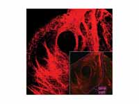 Microscopy of keratin filaments insid...
