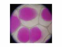 The vacuole of Rhoeo discolor - shrun...