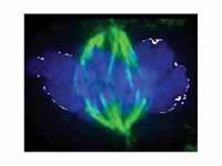 Micrograph showing condensed chromoso...