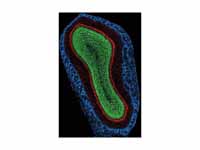 Coronal image of mouse main olfactory...