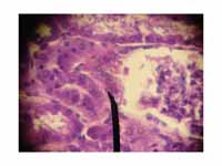 JG cells