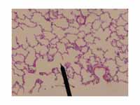 Human alveolar duct